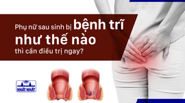 Phụ nữ sau sinh bị bệnh trĩ như thế nào thì cần điều trị ngay?