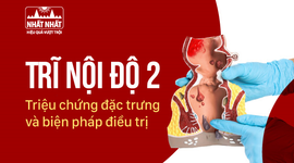 Trĩ nội độ 2: Triệu chứng đặc trưng và biện pháp điều trị 