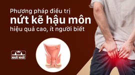 Phương pháp điều trị nứt kẽ hậu môn hiệu quả cao, ít người biết