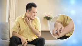 Điều trị viêm gan, men gan cao, khó tiêu, mẩn ngứa, mụn nhọt bằng bài thuốc bổ gan tiêu độc Đông y thế hệ 2, hiệu quả vượt trội