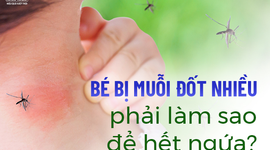 Bé bị muỗi đốt nhiều phải làm sao để hết ngứa?