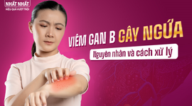 Viêm gan B gây ngứa: Phân tích nguyên nhân và cách xử lý hiệu quả nhất