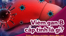 Viêm gan B cấp tính là gì? Triệu chứng và biện pháp điều trị bệnh