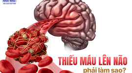 Giải đáp ngay: Thiếu máu lên não phải làm sao?