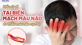 Hiểu rõ về tai biến mạch máu não do thiếu máu não cục bộ