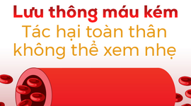 Lưu thông máu kém: Tác hại toàn thân không thể xem nhẹ