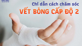 Chỉ dẫn cách chăm sóc vết bỏng cấp độ 2 tại nhà