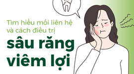 Tìm hiểu mối liên hệ và cách điều trị sâu răng viêm lợi