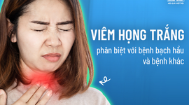 Viêm họng trắng – phân biệt với bệnh bạch hầu và bệnh khác