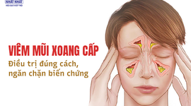 Viêm mũi xoang cấp: Điều trị đúng cách, ngăn chặn biến chứng