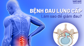 Bệnh đau lưng cấp: Làm sao để giảm nhanh cơn đau dữ dội?