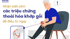 Nhận biết sớm các triệu chứng thoái hóa khớp gối để điều trị ngay