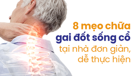 8 mẹo chữa gai đốt sống cổ tại nhà đơn giản, dễ thực hiện