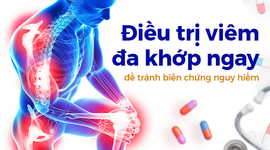 Điều trị viêm đa khớp ngay để tránh biến chứng nguy hiểm