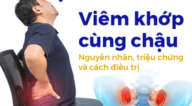 Viêm khớp cùng chậu: Nguyên nhân, triệu chứng và cách điều trị