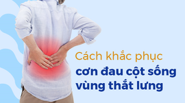Cách khắc phục cơn đau cột sống vùng thắt lưng