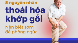 5 nguyên nhân thoái hóa khớp gối: Nên biết sớm để phòng ngừa