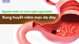 Tìm hiểu nguyên nhân và cách ngăn ngừa bệnh xung huyết niêm mạc dạ dày