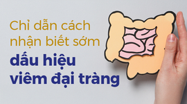 Chỉ dẫn cách nhận biết sớm dấu hiệu viêm đại tràng