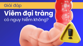 Giải đáp: Viêm đại tràng có nguy hiểm không?