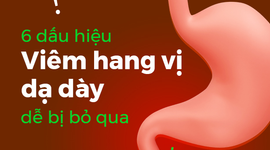 6 dấu hiệu viêm hang vị dạ dày dễ bị bỏ qua