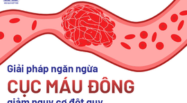 Áp dụng ngay giải pháp ngăn ngừa cục máu đông, giảm nguy cơ đột quỵ