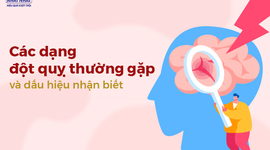 Các dạng đột quỵ thường gặp và dấu hiệu nhận biết đột quỵ