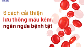 6 cách cải thiện lưu thông máu kém, ngăn ngừa bệnh tật