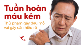 Tuần hoàn máu kém – Thủ phạm gây đau mỏi vai gáy cần hiểu rõ