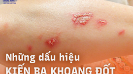 Những dấu hiệu kiến ba khoang đốt dễ nhận biết