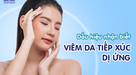 Dấu hiệu nhận biết viêm da tiếp xúc dị ứng phổ biến nhất 