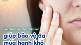 Học nhanh các cách chăm sóc giúp bảo vệ da mùa hanh khô 