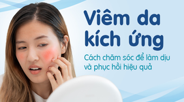 Viêm da kích ứng: Cách chăm sóc để làm dịu và phục hồi hiệu quả