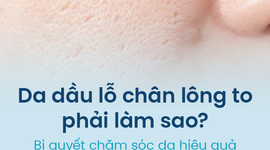 Da dầu lỗ chân lông to phải làm sao? Bí quyết chăm sóc da hiệu quả