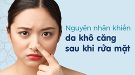 Nguyên nhân khiến da khô căng sau khi rửa mặt 