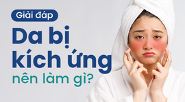 Giải đáp: Da bị kích ứng nên làm gì?