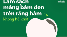 Làm sạch mảng bám đen trên răng hàm không hề khó!