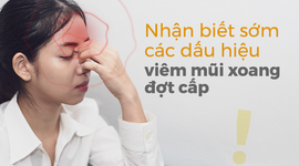 Nhận biết sớm các dấu hiệu viêm mũi xoang đợt cấp