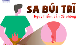 Sa búi trĩ – bệnh tế nhị nhưng nguy hiểm, cần đề phòng