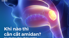 Khi nào thì cần cắt amidan? Cách phương pháp cắt bỏ amidan hiện nay