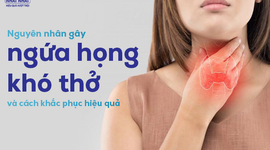 Giải thích nguyên nhân gây ngứa họng khó thở và cách khắc phục hiệu quả