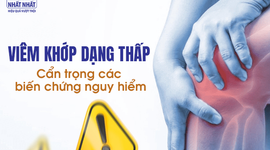 Viêm khớp dạng thấp: Cẩn trọng các biến chứng nguy hiểm
