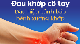 Đau khớp cổ tay: Dấu hiệu cảnh báo bệnh xương khớp