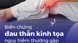Biến chứng đau thần kinh tọa nguy hiểm thường gặp