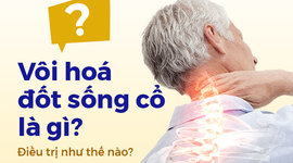 Vôi hóa đốt sống cổ là gì? Điều trị như thế nào?