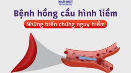Bệnh hồng cầu hình liềm và những biến chứng nguy hiểm