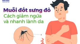 Muỗi đốt sưng đỏ: Cách giảm ngứa và nhanh lành da
