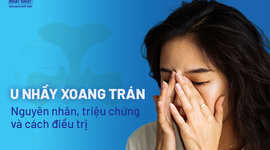 U nhầy xoang trán: Nguyên nhân, triệu chứng và cách điều trị
