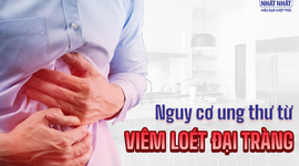 Nguy cơ ung thư từ viêm loét đại tràng: Chớ chủ quan!