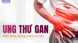 Ung thư gan: Các biện pháp phòng tránh ngay từ sớm nên thực hiện ngay